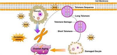 The Role of Oxidative Stress and Natural Antioxidants in Ovarian Aging